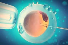 乐山试管婴儿到哪里去做，乐山本地有吗